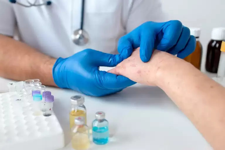 接種猴痘疫苗可以有效預防感染猴痘嗎？